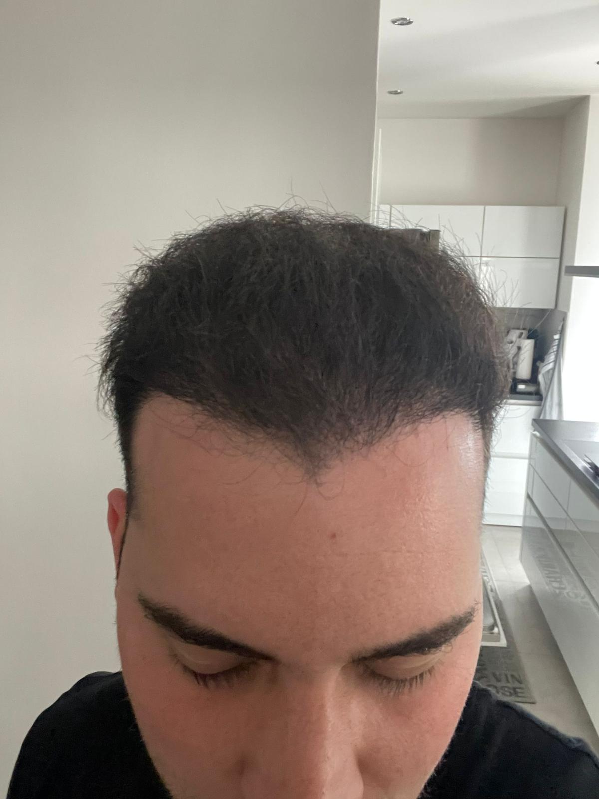 Ein Mann mit dunklem Haar schaut nach unten, im Hintergrund eine helle moderne Küche